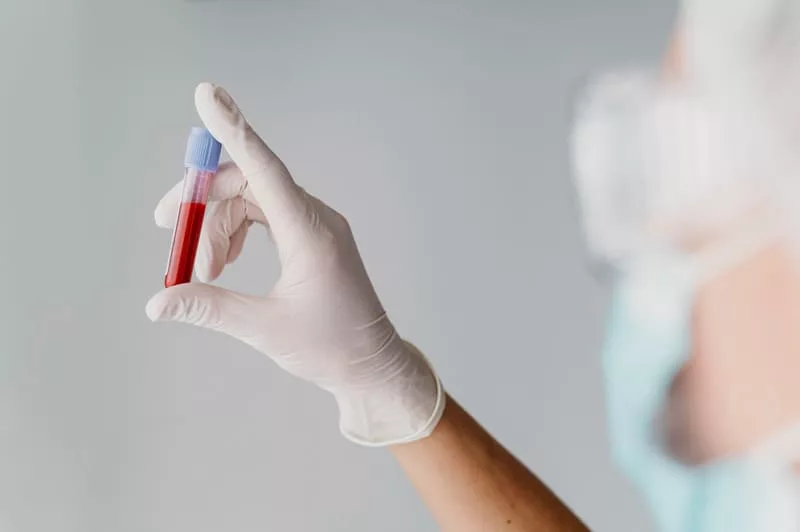O ferro é importante para a formação das células vermelhas do sangue. Fonte da imagem: Freepik.